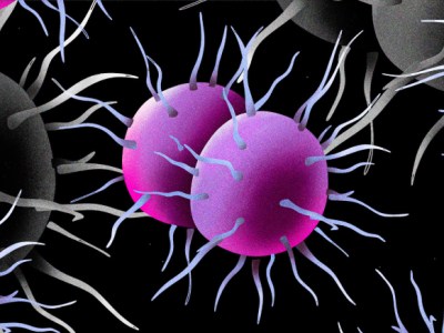 Gonorrhoea: 5 frequently asked questions,&nbsp;answered